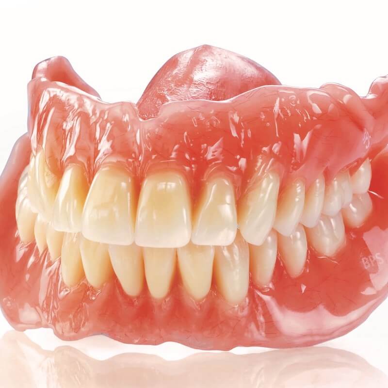 BPS義歯（入れ歯）